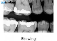 ضخامت بالا دستگاه دندانپزشکی X ray دستگاه قابل حمل Dental X X واحد ضمانت 1 سال ضمانت